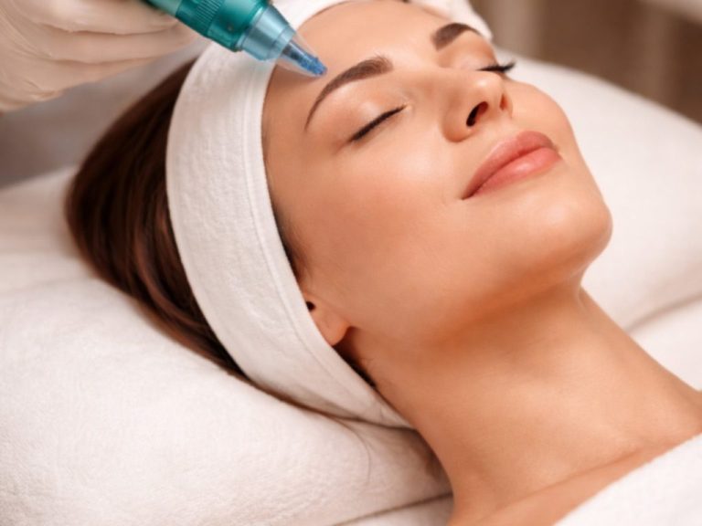 Microneedling Gesichtsbehandlung mit Dermapen bei Feingefühl mobile Kosmetik in Hünxe für ein verfeinertes Hautbild.